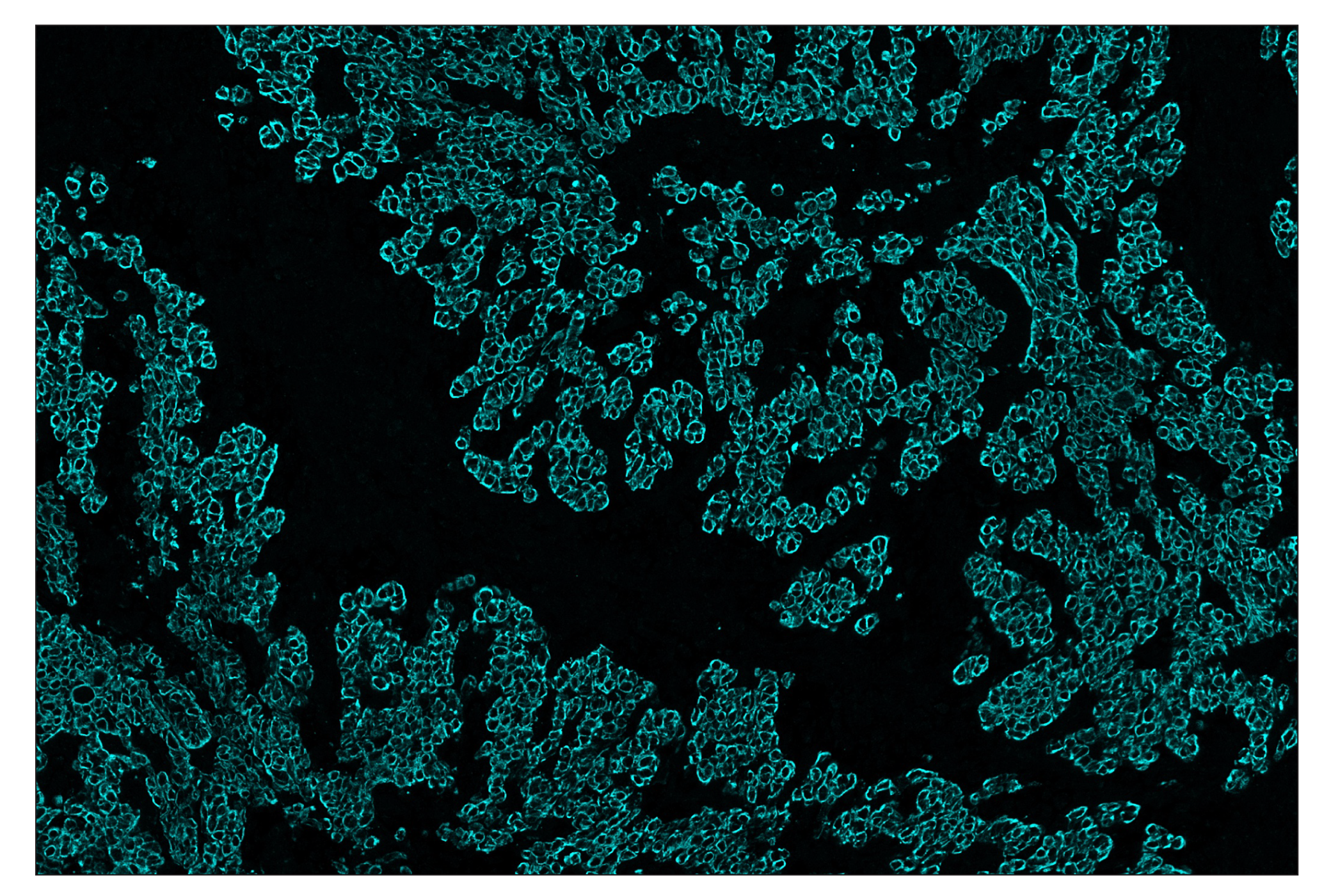 Immunohistochemistry Image 5: Pan-Keratin (C11) & CO-0003-594 SignalStar™ Oligo-Antibody Pair