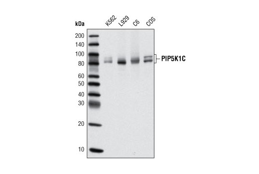 Western Blotting Image 1: PIP5K1C Antibody