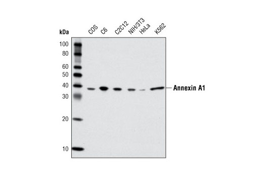 Western Blotting Image 1: Annexin A1 Antibody