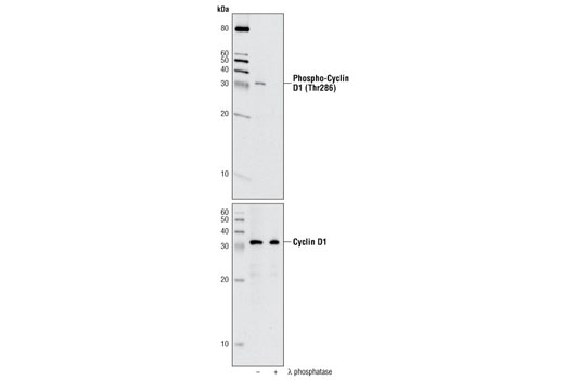Western Blotting Image 1: Phospho-Cyclin D1 (Thr286) (D29B3) XP® Rabbit mAb