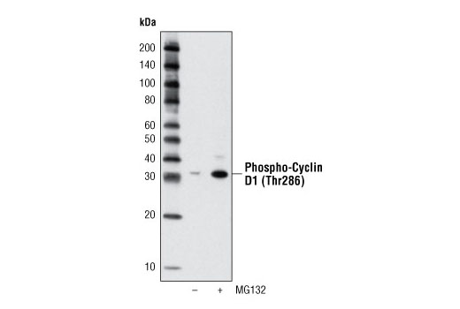 Western Blotting Image 2: Phospho-Cyclin D1 (Thr286) (D29B3) XP® Rabbit mAb
