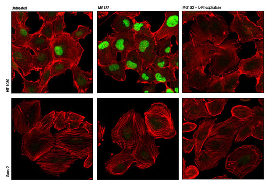 Immunofluorescence Image 1: Phospho-Cyclin D1 (Thr286) (D29B3) XP® Rabbit mAb