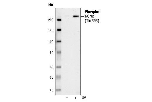 Western Blotting Image 1: Phospho-GCN2 (Thr898) Antibody
