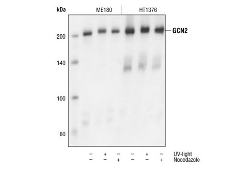 Western Blotting Image 1: GCN2 Antibody
