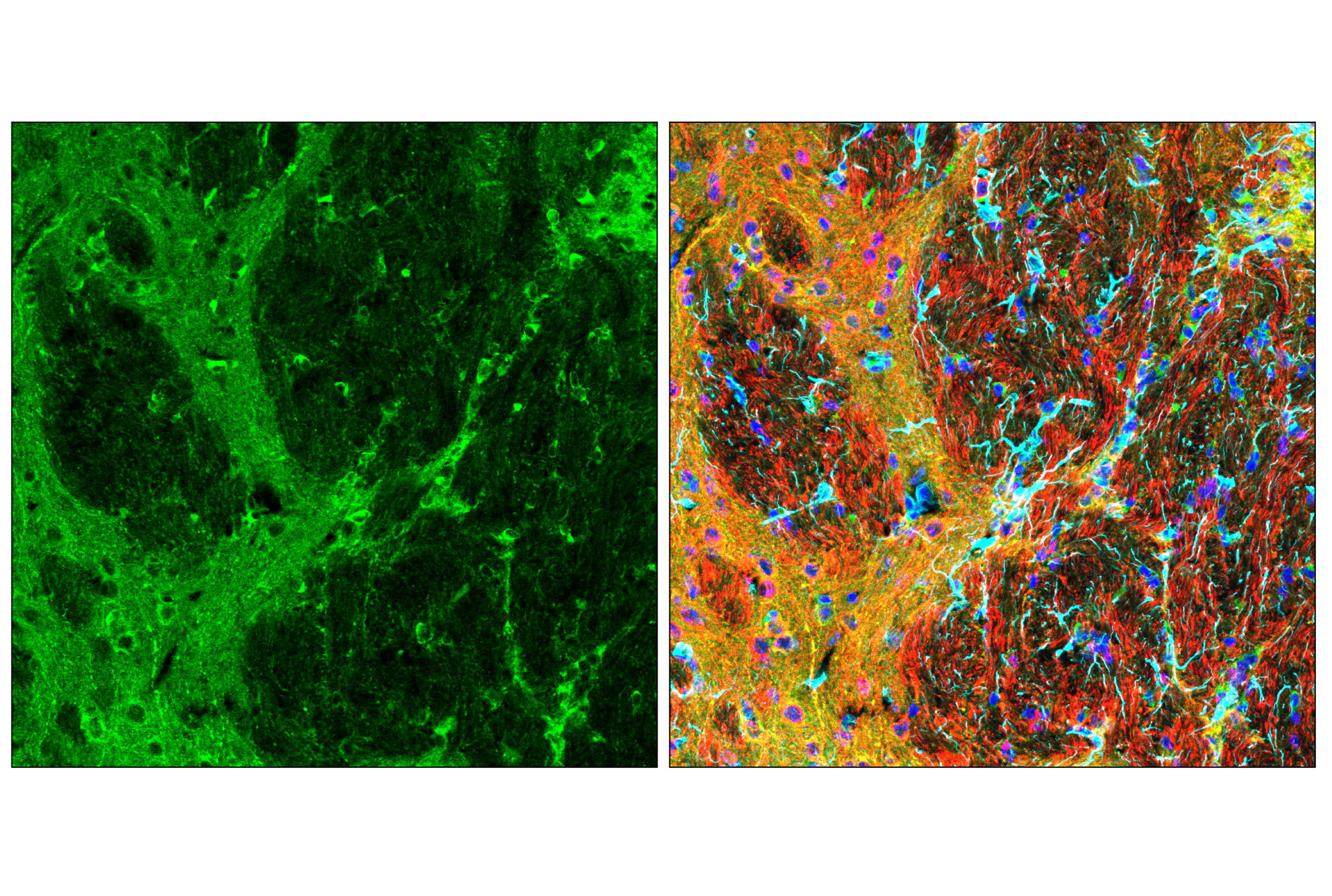 Immunofluorescence Image 3: Phospho-Tau (Thr205) (E9A7P) Mouse mAb