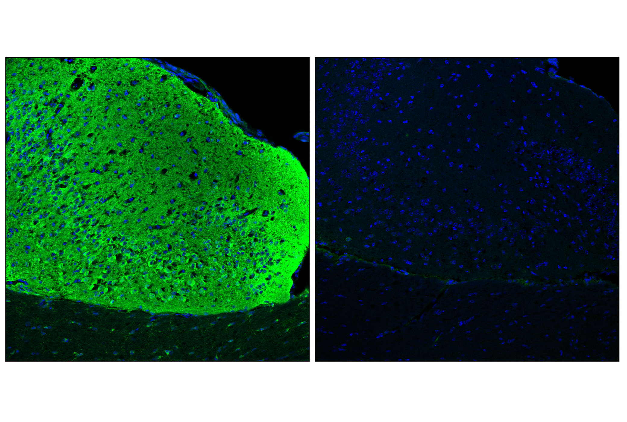 Immunofluorescence Image 1: Phospho-Tau (Thr205) (E9A7P) Mouse mAb
