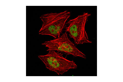 Immunofluorescence Image 1: GCN5L2 (C26A10) Rabbit mAb