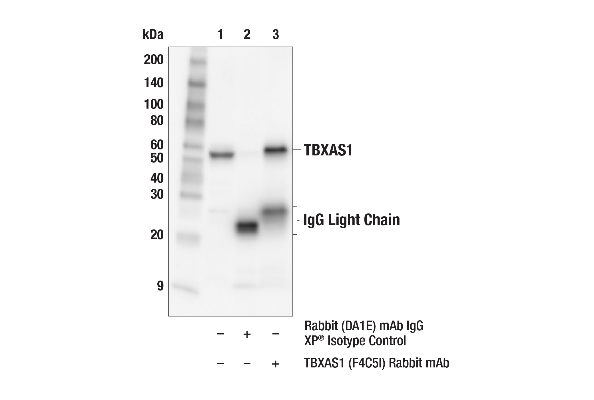 Immunoprecipitation Image 1: TBXAS1 (F4C5I) Rabbit mAb