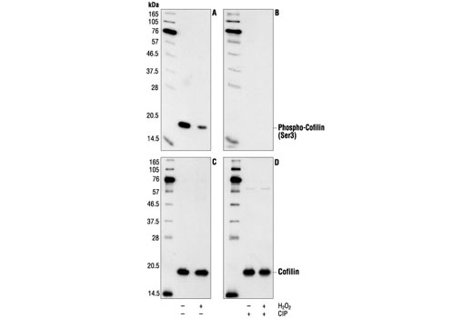 Western Blotting Image 1: Phospho-Cofilin (Ser3) Antibody