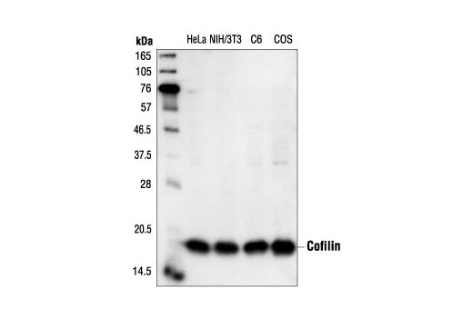 Western Blotting Image 1: Cofilin Antibody