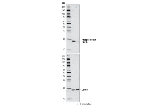 Western Blotting Image 1: Phospho-Cofilin (Ser3) (77G2) Rabbit mAb