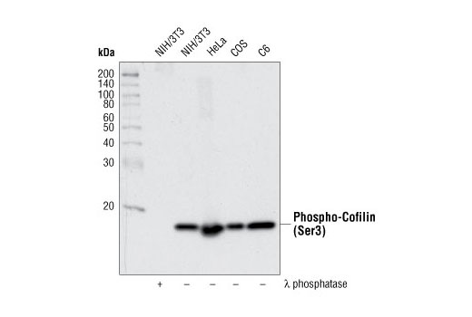Western Blotting Image 2: Phospho-Cofilin (Ser3) (77G2) Rabbit mAb