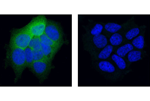 Immunofluorescence Image 1: Phospho-Cofilin (Ser3) (77G2) Rabbit mAb