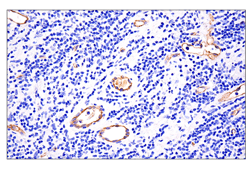 Immunohistochemistry Image 4: VE-Cadherin (E6N7A) Rabbit mAb (BSA and Azide Free)