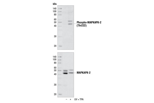  Image 6: MAPKAPK-2 Antibody Sampler Kit