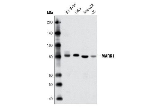 Western Blotting Image 1: MARK1 Antibody