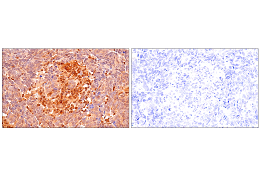 Immunohistochemistry Image 13: p70 S6 Kinase (E8K6T) Rabbit Monoclonal Antibody (BSA and Azide Free)