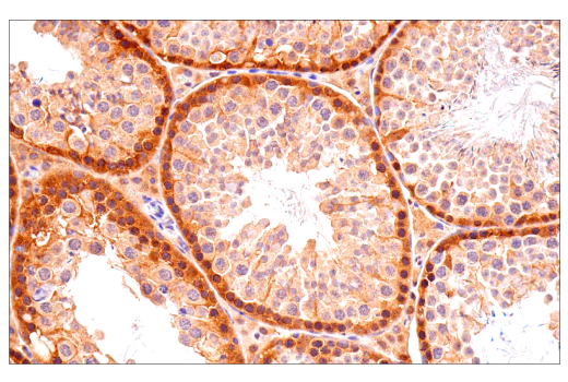 Immunohistochemistry Image 6: p70 S6 Kinase (E8K6T) Rabbit Monoclonal Antibody (BSA and Azide Free)