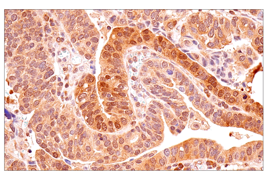 Immunohistochemistry Image 1: p70 S6 Kinase (E8K6T) Rabbit Monoclonal Antibody (BSA and Azide Free)
