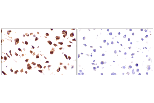 Immunohistochemistry Image 14: p70 S6 Kinase (E8K6T) Rabbit Monoclonal Antibody (BSA and Azide Free)