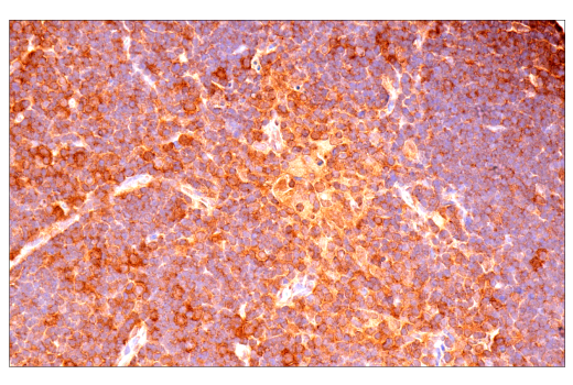 Immunohistochemistry Image 8: p70 S6 Kinase (E8K6T) Rabbit Monoclonal Antibody (BSA and Azide Free)