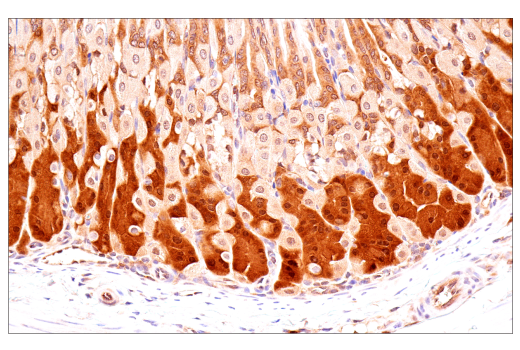 Immunohistochemistry Image 9: p70 S6 Kinase (E8K6T) Rabbit Monoclonal Antibody (BSA and Azide Free)