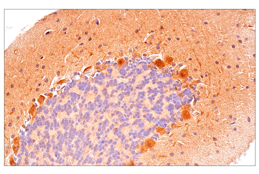 Immunohistochemistry Image 11: p70 S6 Kinase (E8K6T) Rabbit Monoclonal Antibody (BSA and Azide Free)