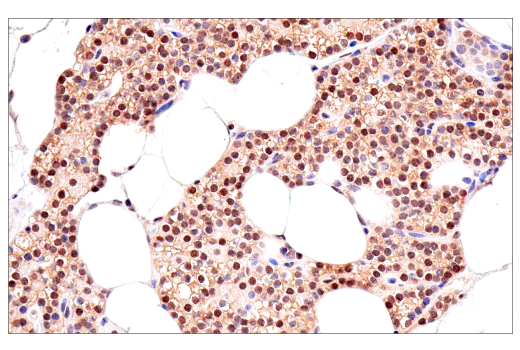 Immunohistochemistry Image 5: p70 S6 Kinase (E8K6T) Rabbit Monoclonal Antibody (BSA and Azide Free)