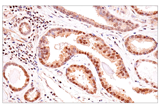 Immunohistochemistry Image 3: p70 S6 Kinase (E8K6T) Rabbit Monoclonal Antibody (BSA and Azide Free)