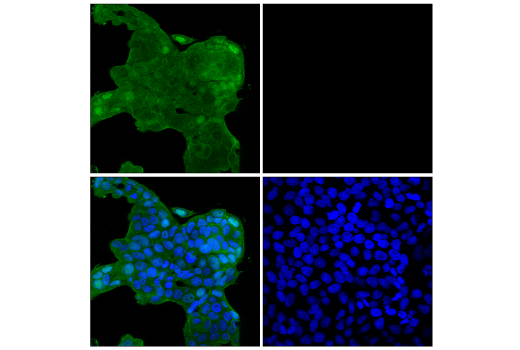 Immunofluorescence Image 1: p70 S6 Kinase (E8K6T) Rabbit Monoclonal Antibody (BSA and Azide Free)