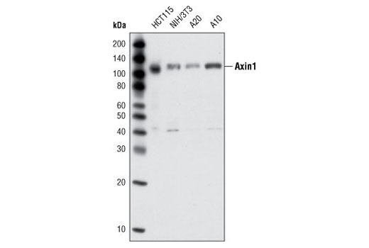 Western Blotting Image 1: Axin1 (C7B12) Rabbit mAb