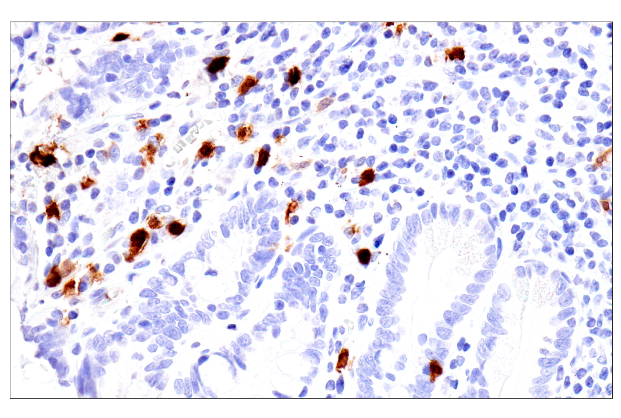 Immunohistochemistry Image 9: S100A8 (F4R2W) Rabbit mAb
