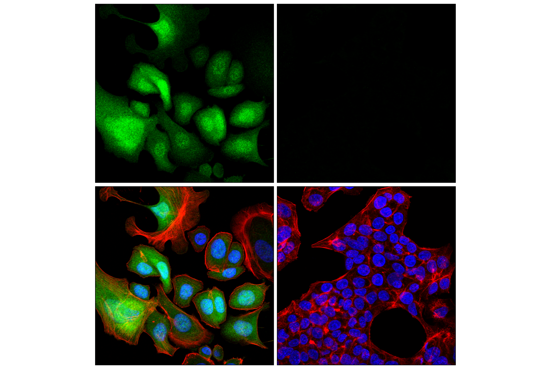 Immunofluorescence Image 1: S100A8 (F4R2W) Rabbit mAb