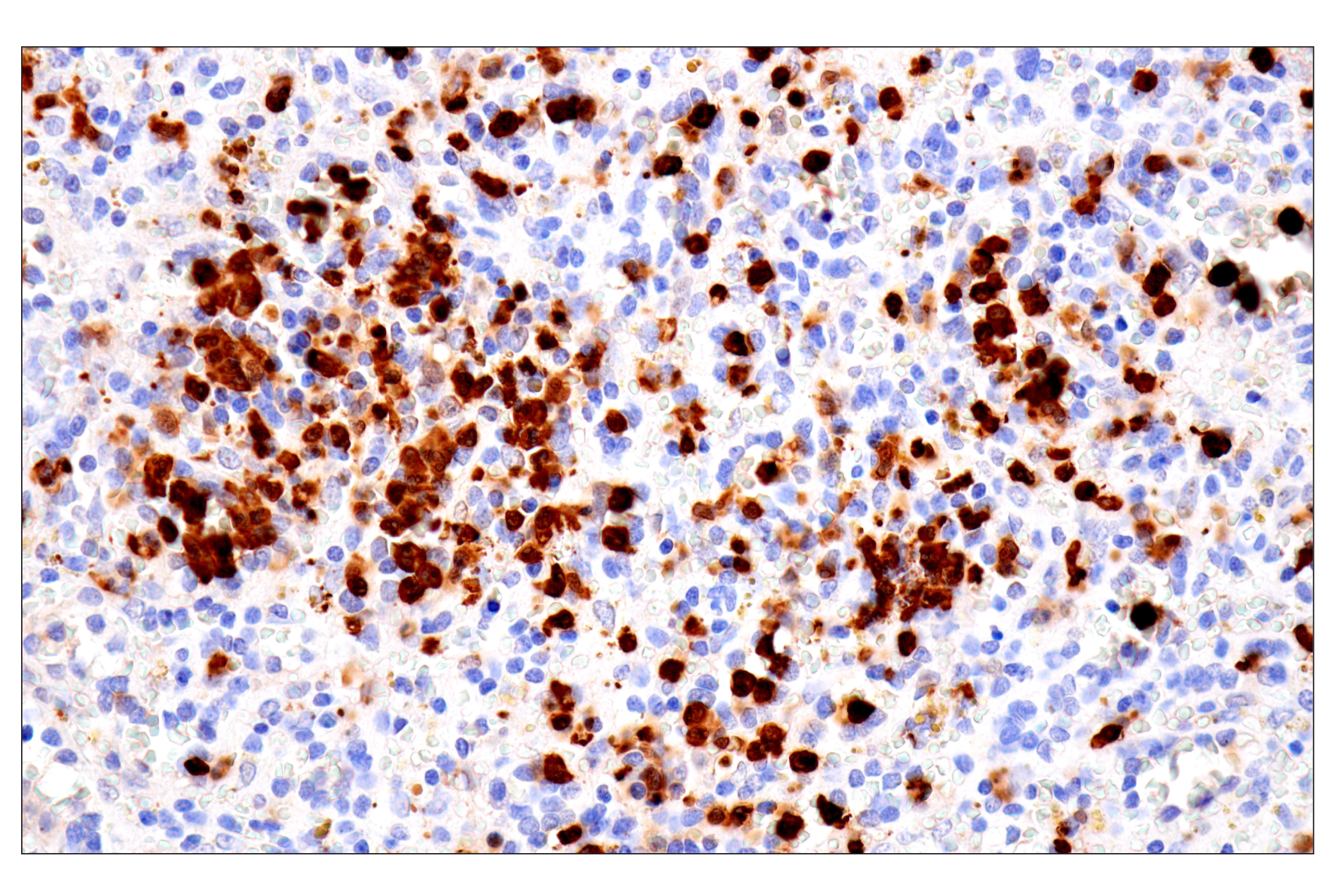 Immunohistochemistry Image 7: S100A8 (F4R2W) Rabbit mAb
