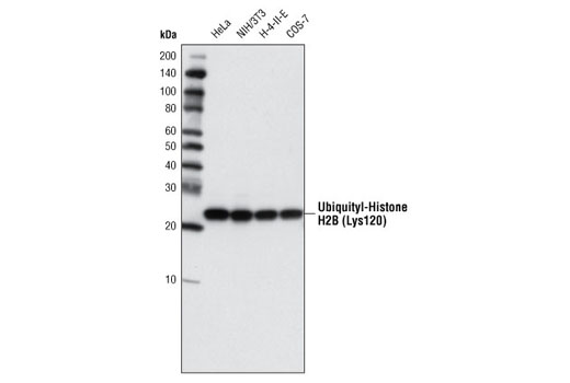 Western Blotting Image 1: Ubiquityl-Histone H2B (Lys120) (D11) XP® Rabbit mAb (BSA and Azide Free)