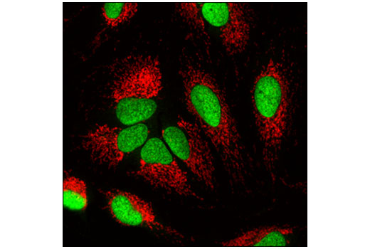 Immunofluorescence Image 1: Ubiquityl-Histone H2B (Lys120) (D11) XP® Rabbit mAb (BSA and Azide Free)
