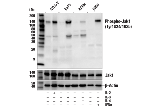 Western Blotting Image 1: Phospho-Jak1 (Tyr1034/1035) Antibody