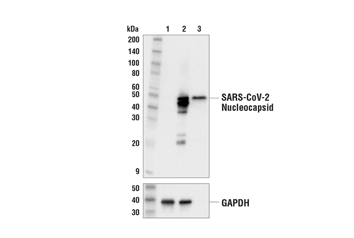Western Blotting Image 1: SARS-CoV-2 Nucleocapsid Protein Antibody