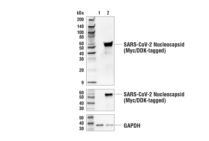 Western Blotting Image 3: SARS-CoV-2 Nucleocapsid Protein Antibody