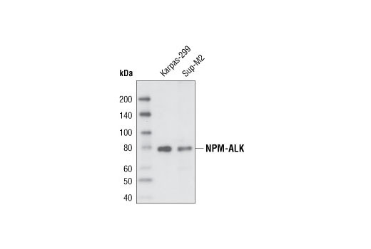  Image 3: ALK Antibody Sampler Kit