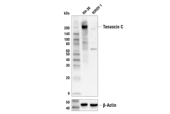 Western Blotting Image 1: Tenascin C (E5J3B) Rabbit mAb