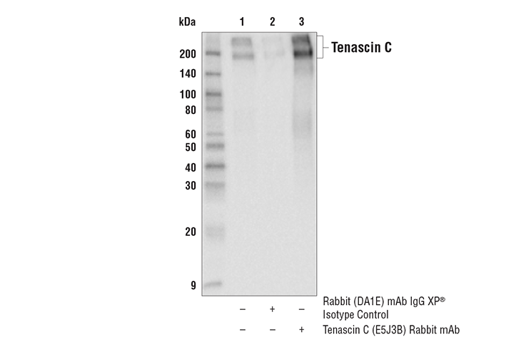 Immunoprecipitation Image 1: Tenascin C (E5J3B) Rabbit mAb