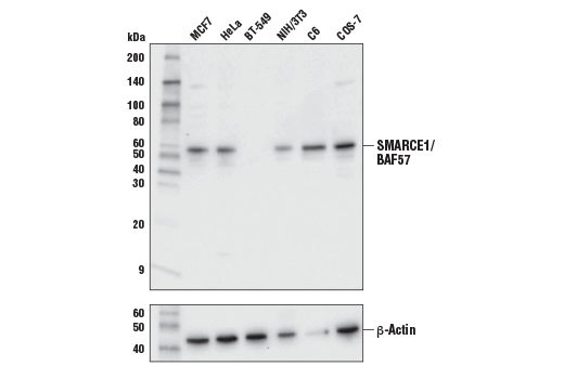SMARCE1/BAF57 (E6H5J) Rabbit mAb | Cell Signaling Technology