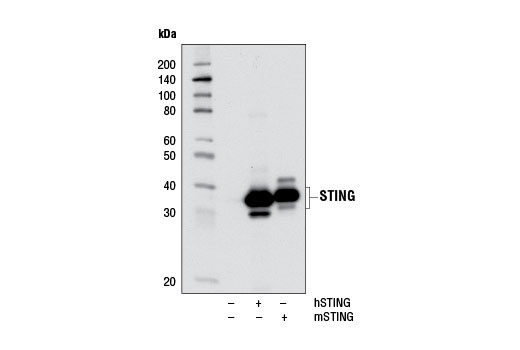 Western Blotting Image 1: STING Antibody