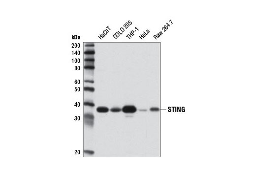 Western Blotting Image 2: STING Antibody