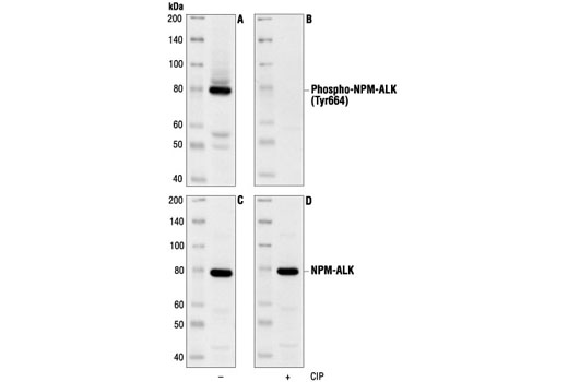 Western Blotting Image 1: Phospho-ALK (Tyr1604) Antibody