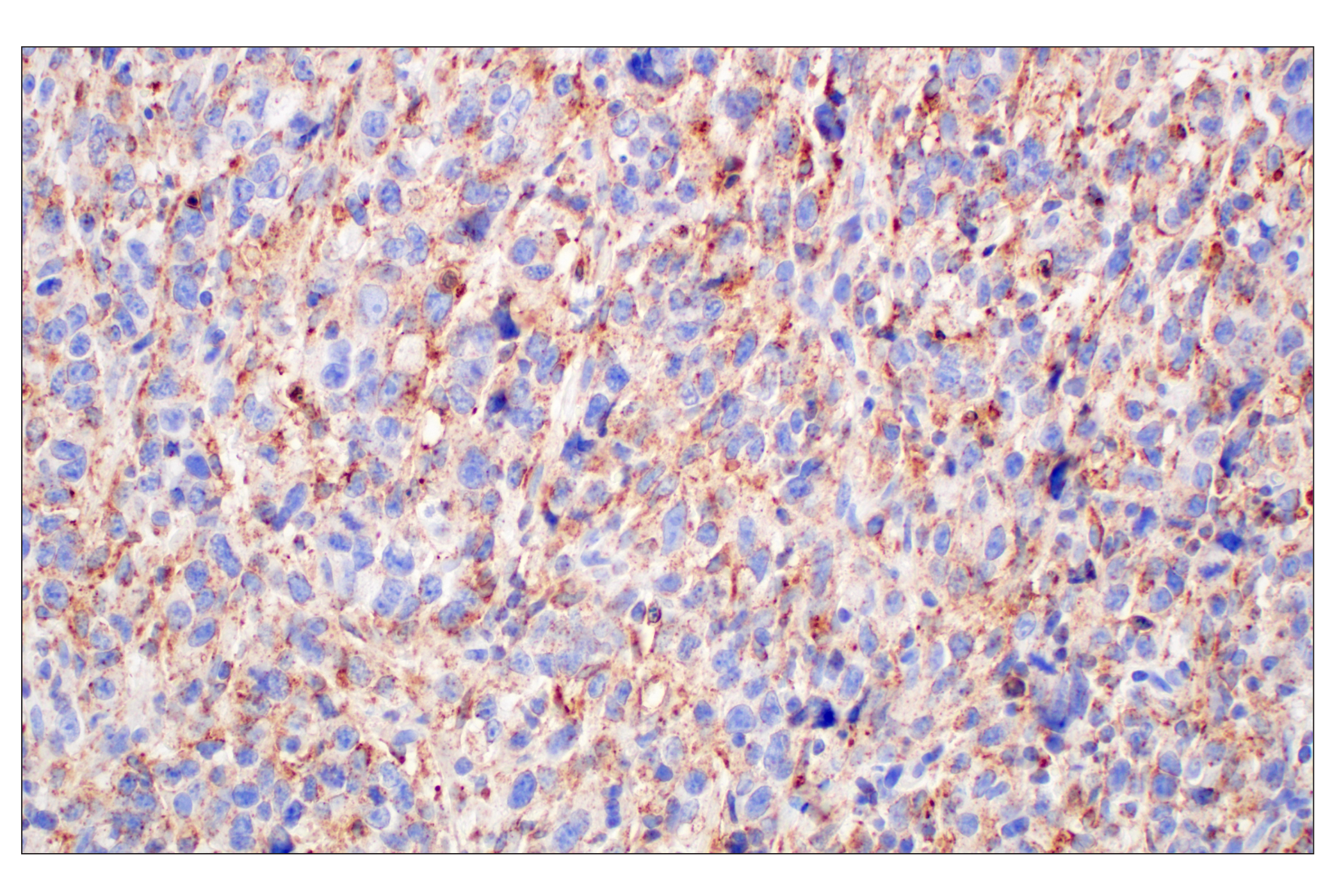 Immunohistochemistry Image 8: NPC1 (E7S4N) Rabbit mAb