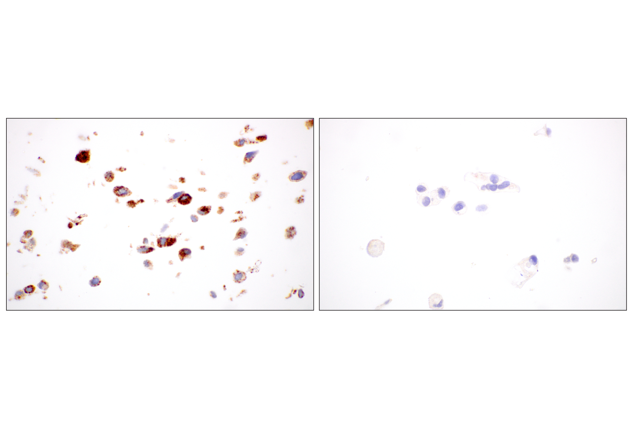 Immunohistochemistry Image 12: NPC1 (E7S4N) Rabbit mAb