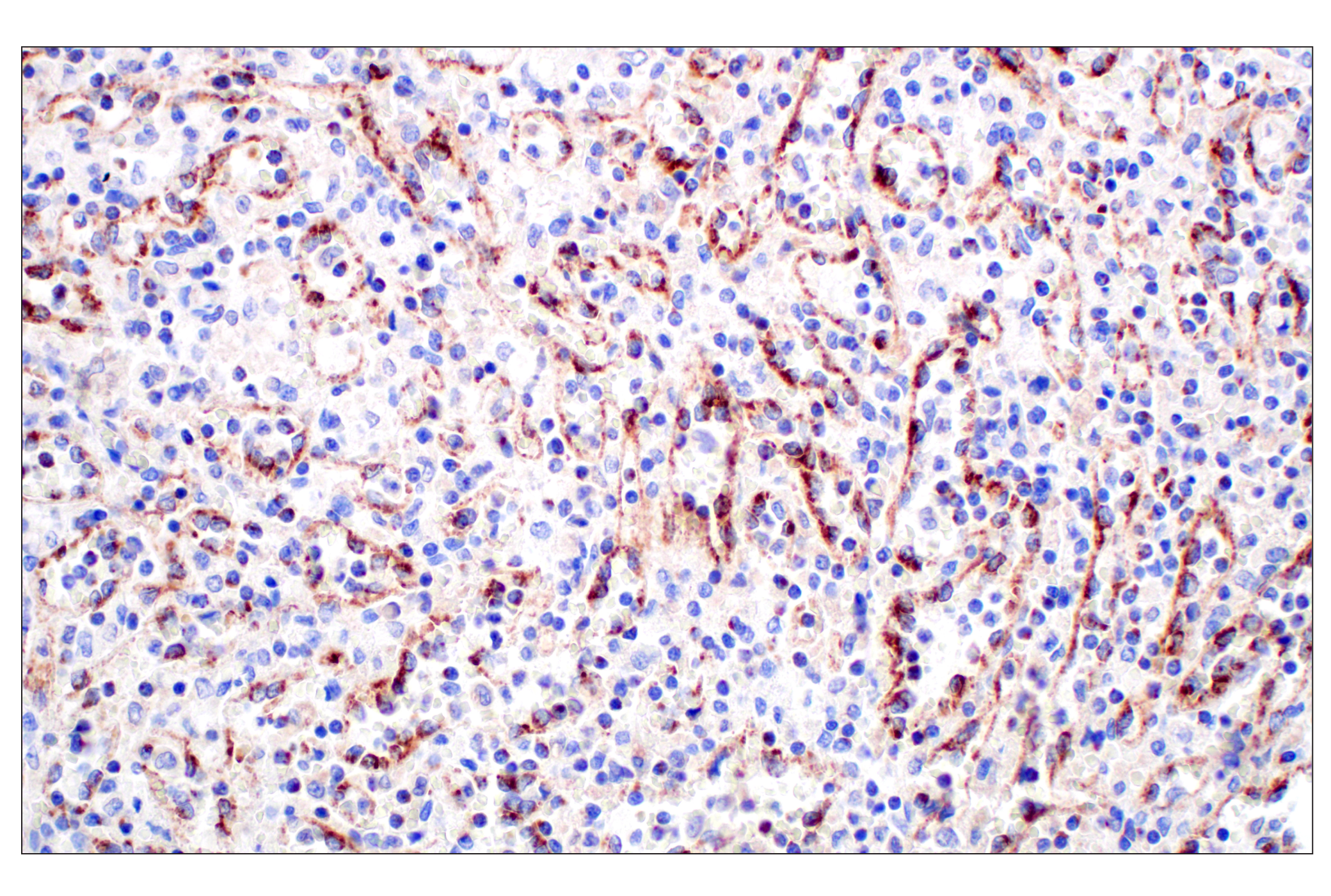 Immunohistochemistry Image 5: NPC1 (E7S4N) Rabbit mAb