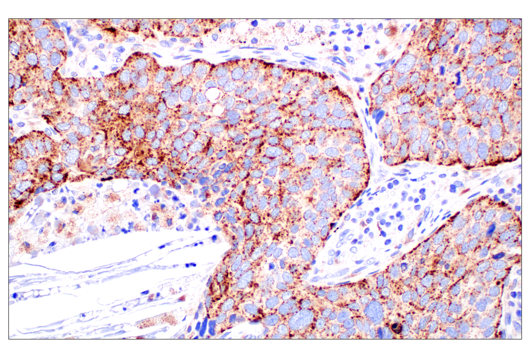 Immunohistochemistry Image 1: NPC1 (E7S4N) Rabbit mAb